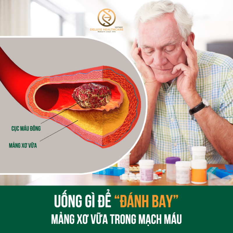 mảng xơ vữa2